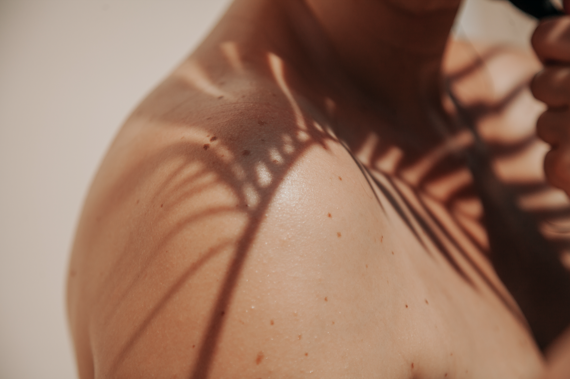 Body with leaf pattern on skin